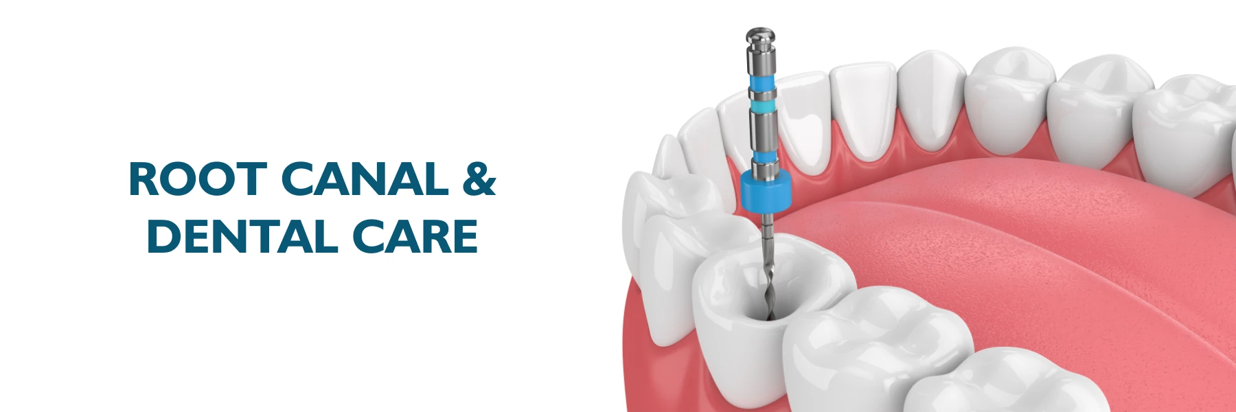 Dental Care In Vizag