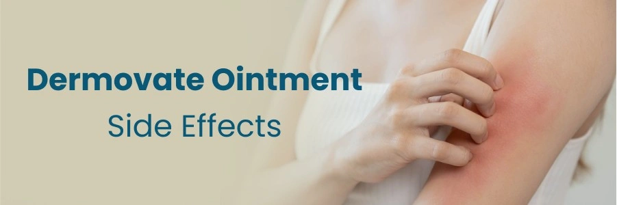 Dermovate Ointment Side Effects