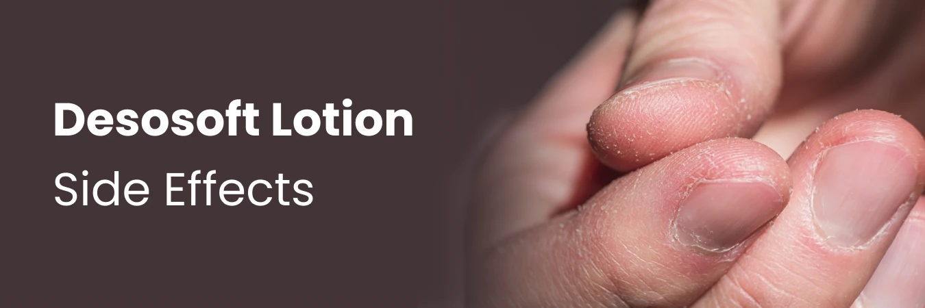 Desosoft Lotion Side Effects