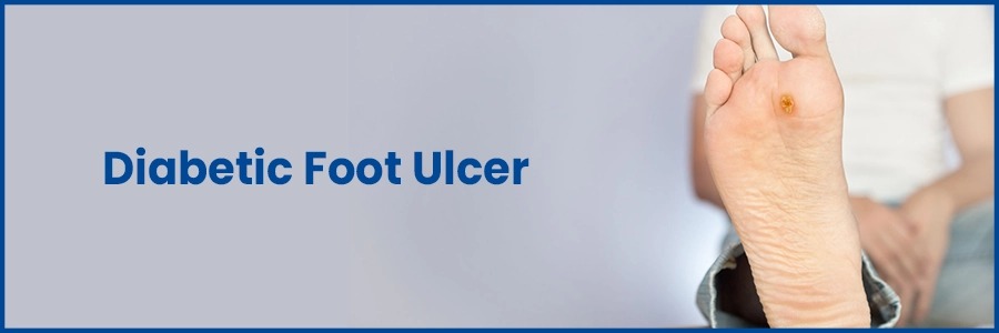 Diabetic Foot Ulcer: Effective Wound Care Treatment and Prevention