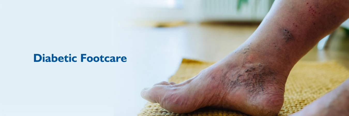 Diabetic Footcare Diabetic Footcare