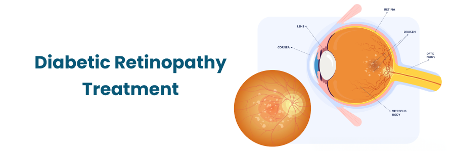 Expert Diabetic Retinopathy Treatment & Care in Begumpet