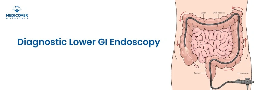 Lower GI Endoscopy Test in Chh. Sambhaji Nagar: What to Expect & Benefits