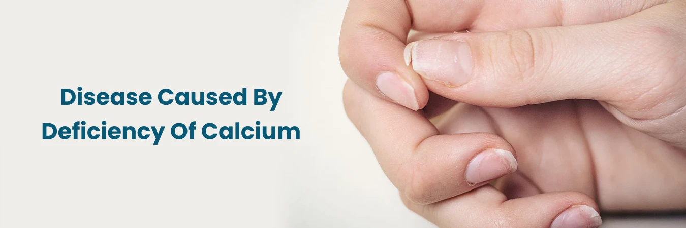 Disease Caused By Calcium Deficiency