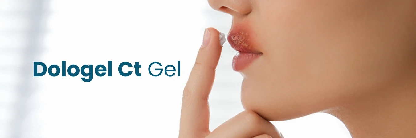 What is Dologel Ct Gel