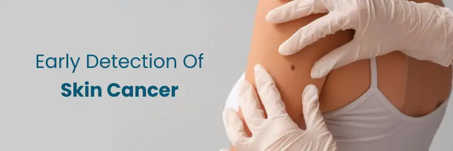 Early Detection Of Skin Cancer
