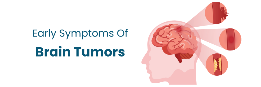 Early Symptoms of Brain Tumors in Vizag