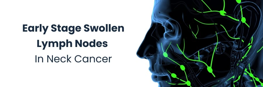 Hand Eczema: Causes & Treatments