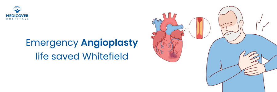 Emergency Angioplasty at Medicover Whitefield Emergency Angioplasty at Medicover Whitefield