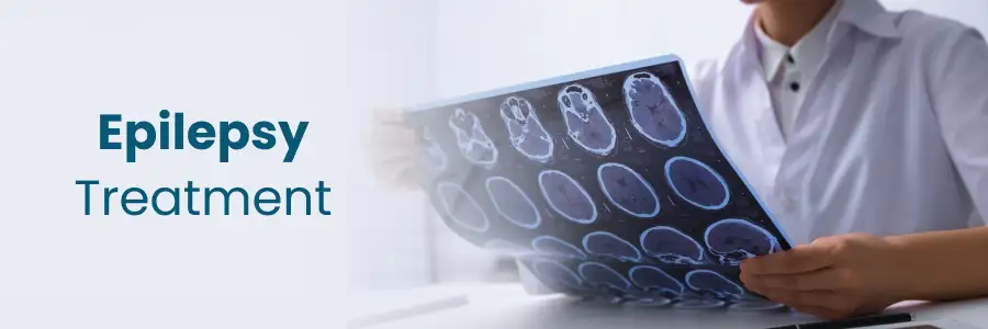 Innovative Approaches to Epilepsy Treatment