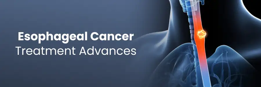 Esophageal cancer treatment advances
