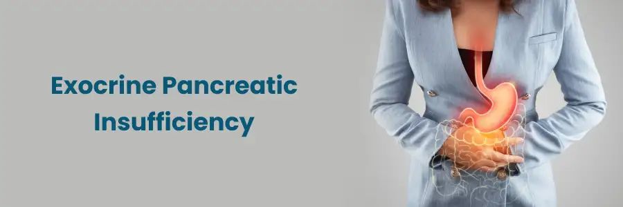 Effective Management of Exocrine Pancreatic Insufficiency