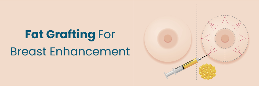 Fat Grafting For Breast Enhancement