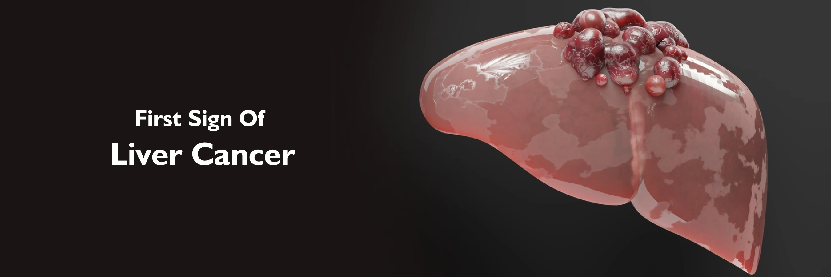 First Sign of Liver Cancer