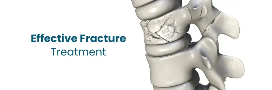 Effective Fracture Treatment and Recovery Strategies