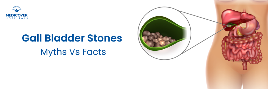 Gall Bladder Stones Myths Gall Bladder Stones Myths