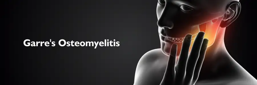 Garres Osteomyelitis