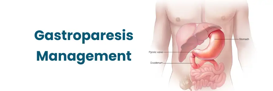  Effective Strategies for Managing Gastroparesis