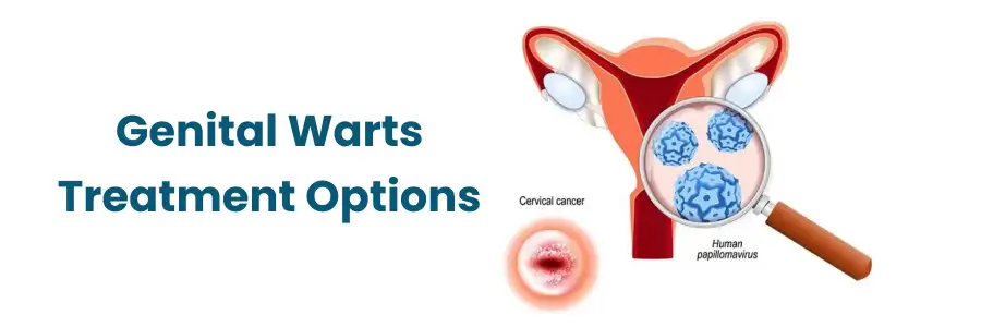 Genital Warts Treatment Options in Begumpet