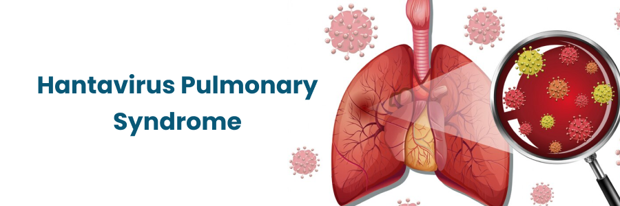 Hantavirus Pulmonary Syndrome