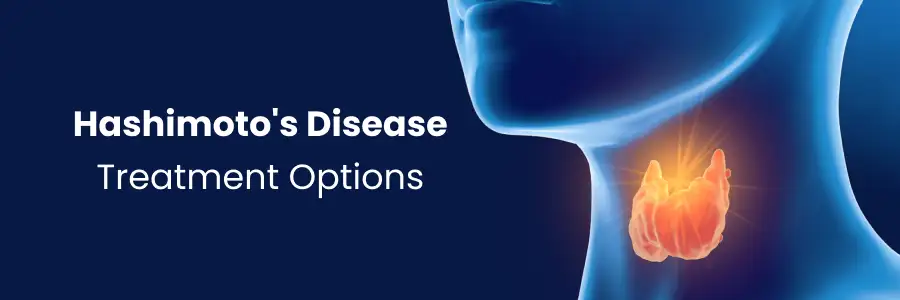 Hashimoto's Disease Treatment Options in Begumpet