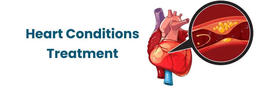Heart Conditions Treatment in Begumpet