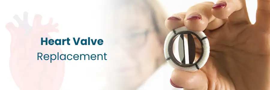 Heart Valve Replacement