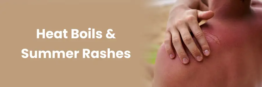 Causes and Remedies for Heat Boils & Summer Rashes