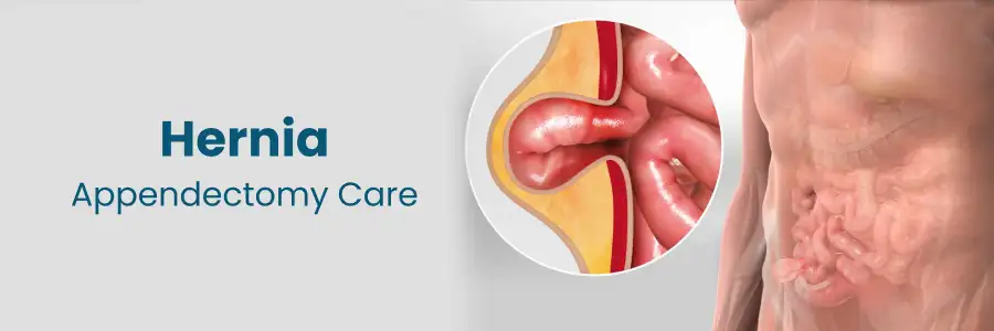 Hernia Appendectomy Care Karimnagar