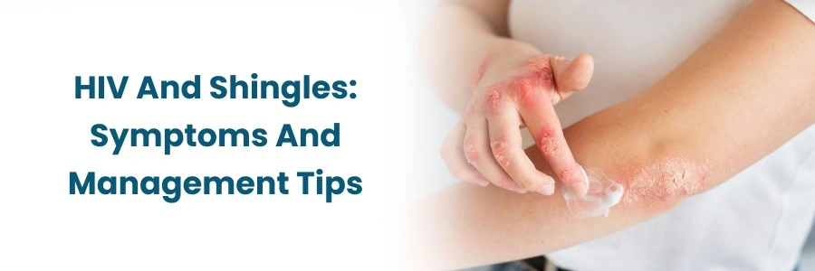 "HIV and Shingles: Symptoms & Management"