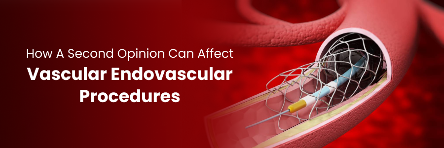 Effect of Second Opinion on Endovascular Procedures