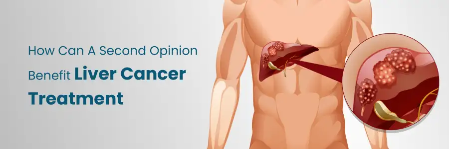 How Second Opinion Benefits Liver Cancer Treatment