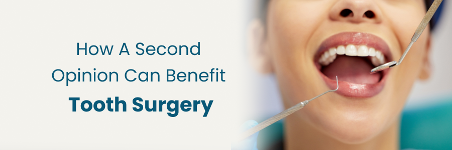 Second opinion benefits tooth surgery