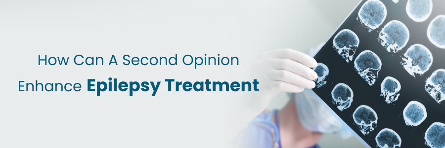 Enhancing epilepsy treatment through second opinion