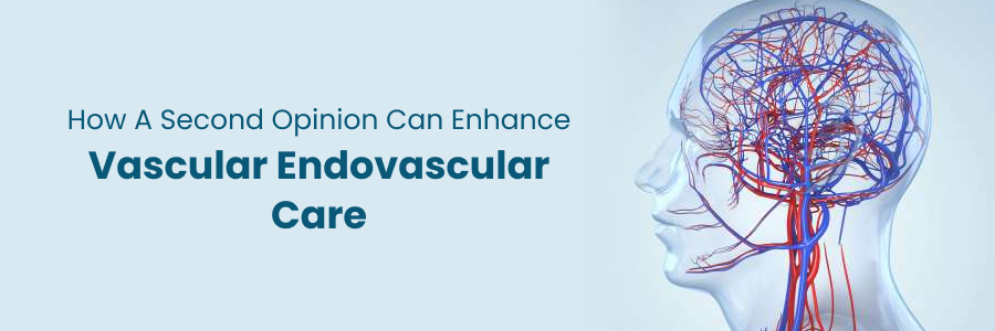 Second Opinions Enhances Vascular Endovascular treatment