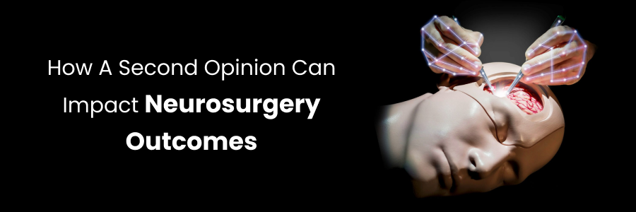 Second opinion impact in neurosurgery