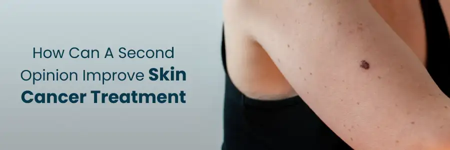How a Second Opinion Can Improve Skin Cancer Treatment