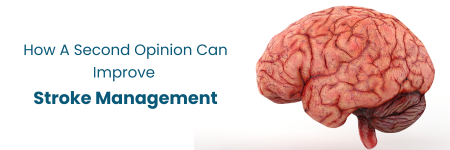 Improving stroke management with second opinion