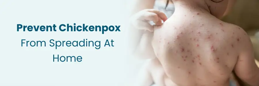 Prevent Chickenpox from Spreading at Home