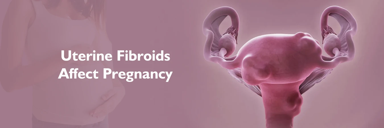 How Uterine Fibroids Affect Pregnancy