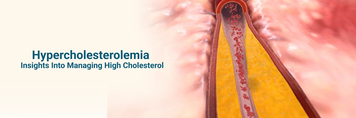 Hypercholesterolemia: Symptoms, Causes and Treatment