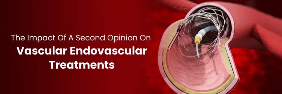 Impact of second opinion on endovascular care