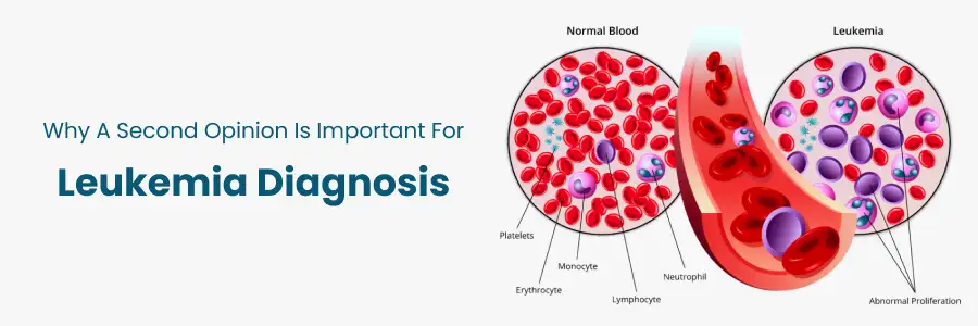 Importance of Second Opinion for Leukemia Diagnosis