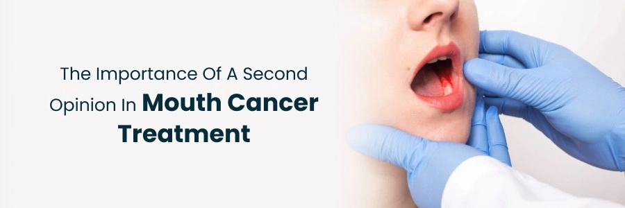 Second Opinion in Mouth Cancer Treatment
