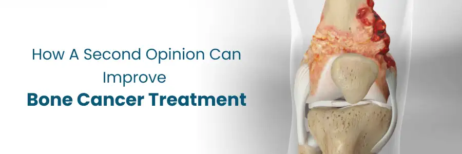 Improve Bone Cancer Treatment with a Second Opinion