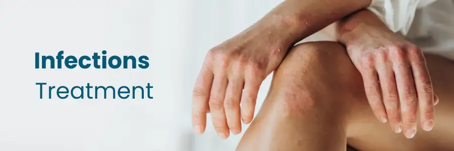 How Are Common Infections Diagnosed and Treated at Medicover Hospital, Begumpet?