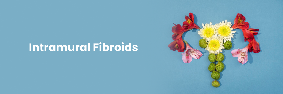 Intramural Fibroids