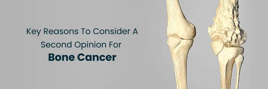 Key Reasons for a Second Opinion on Bone Cancer