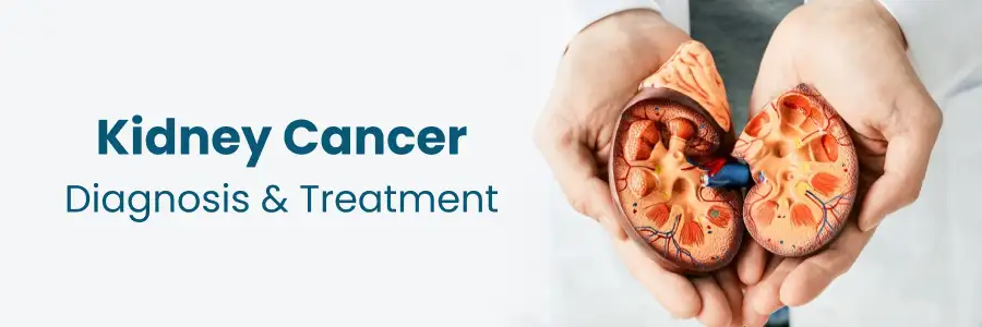 Kidney cancer diagnosis and treatment