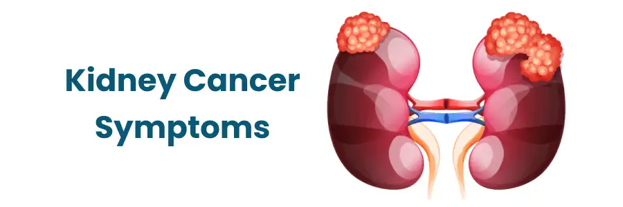Kidney Cancer Symptoms and Early Detection